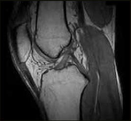 csm s scan Knee 3D SHARC Sagittal