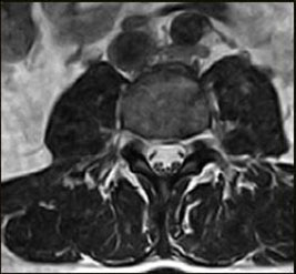 csm s scan L spine 3D HYCE Axial