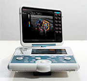 Esaote MyLab™Gamma Breast Imaging Ultrasound System
