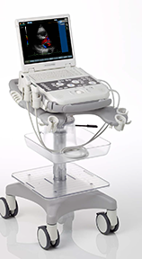 Siemens Acuson P300  Cardiac Ultrasound System