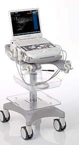 Siemens Acuson P300 Podiatry Imaging Ultrasound System