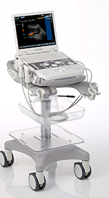 Siemens Acuson P300 Nephrology Imaging Ultrasound System