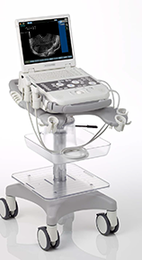 Siemens Acuson P300 OB/GYN Ultrasound System