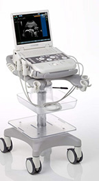 Siemens Acuson P300 Ultrasound System