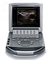 SonoSite M-Turbo Pain Management Ultrasound System