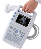 Used SonoSite 180plus Ultrasound System