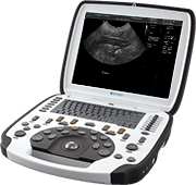 Terason uSmart 3300 Veterinary Ultrasound System